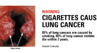 WHO lies about lung cancer big-pharma